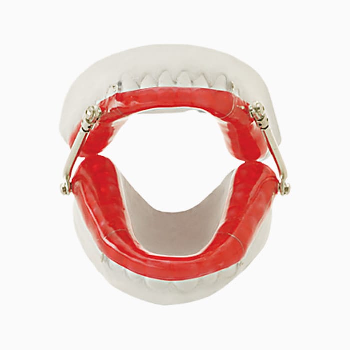 Herbst Sleep Appliance SN/04 – lab3d, Schnarchtherapie