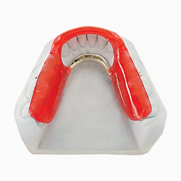 Tanner Splint SP/01