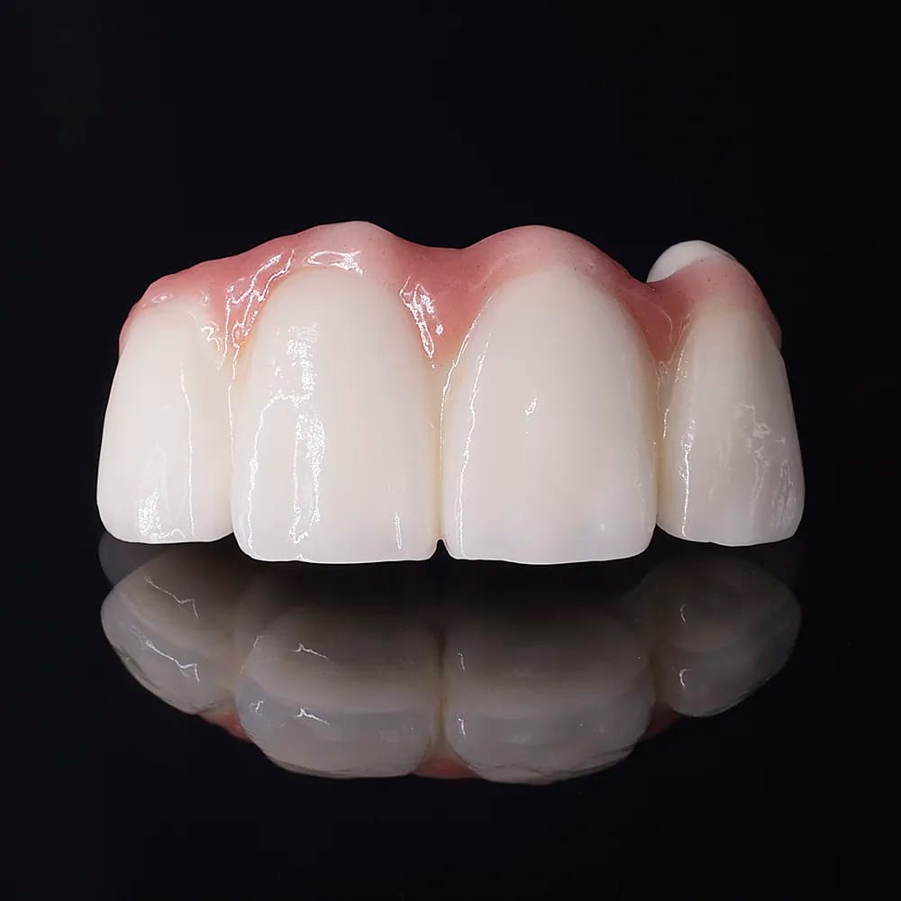 Monolithic Zirconium Crown CA/01 – lab3d, Zirkonoxid