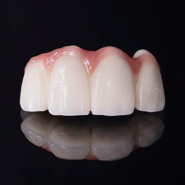 Monolithic Zirconium Crown CA/01