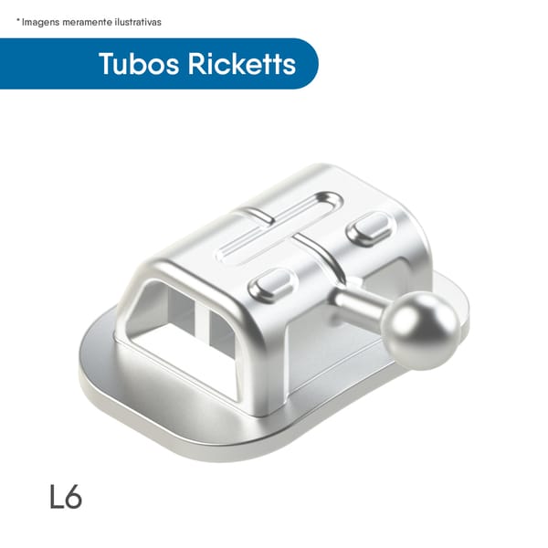 Tubos Ricketts Plus Duplo Colagem - Pacote Unitário 711I1-11147