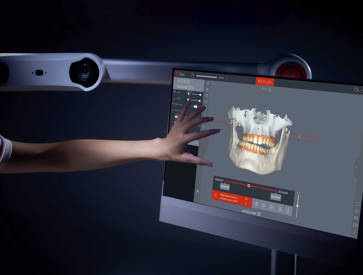 Modjaw™ - solution ALL in ONE – MODJAW, Intraorale Kameras