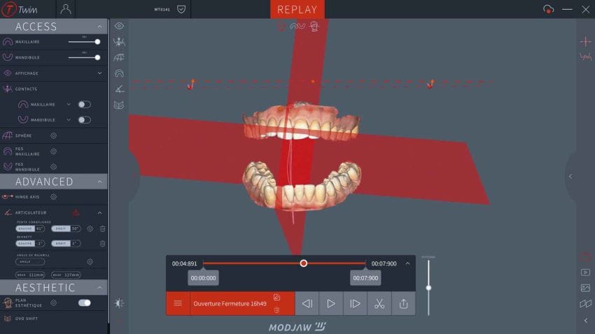 Modjaw™ - Twim Aesthetic – MODJAW, CAD/CAM-Software