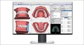 Onyxceph – Organical CAD/CAM, CAD/CAM-Software