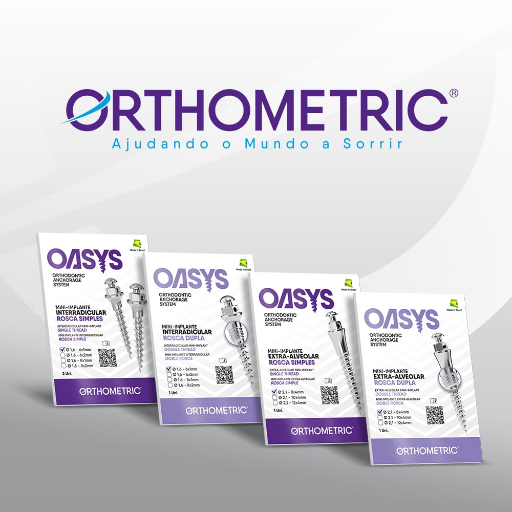 Oasys - Orthodontische Mini-Implantate – Orthometric Industria e Comercio de Produtos Medicos e Odontologicos Ltda., Verankerungssysteme