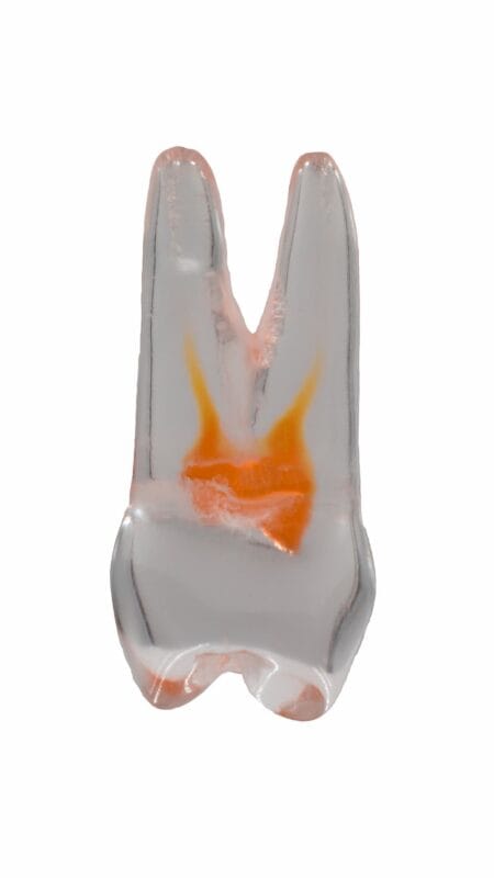 TrueTooth – Prämolar – PlanB Dental, Demomodelle