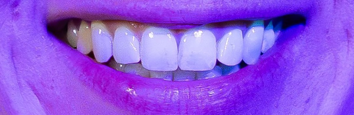 priti®perfect Glaze Extra Fluo – Pritidenta GmbH, Färbeliquids und Zubehör