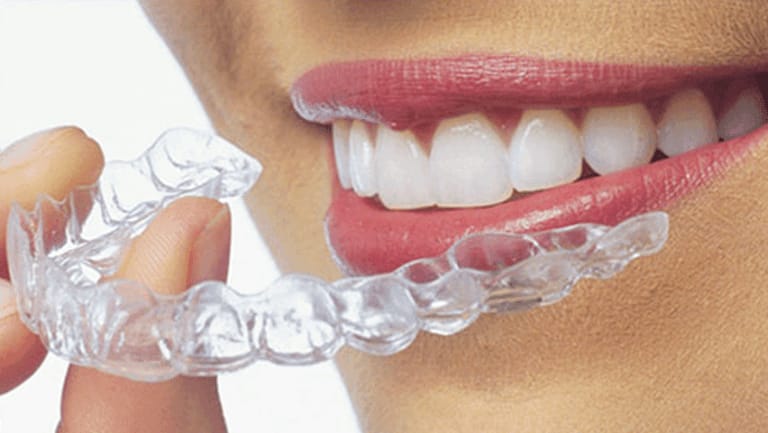 P223 PRO – Láminas para alineadores Sabilex Align Multilayer – FLEXAFIL, Tiefziehfolien und -platten