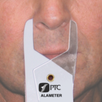 PTC Alameter
