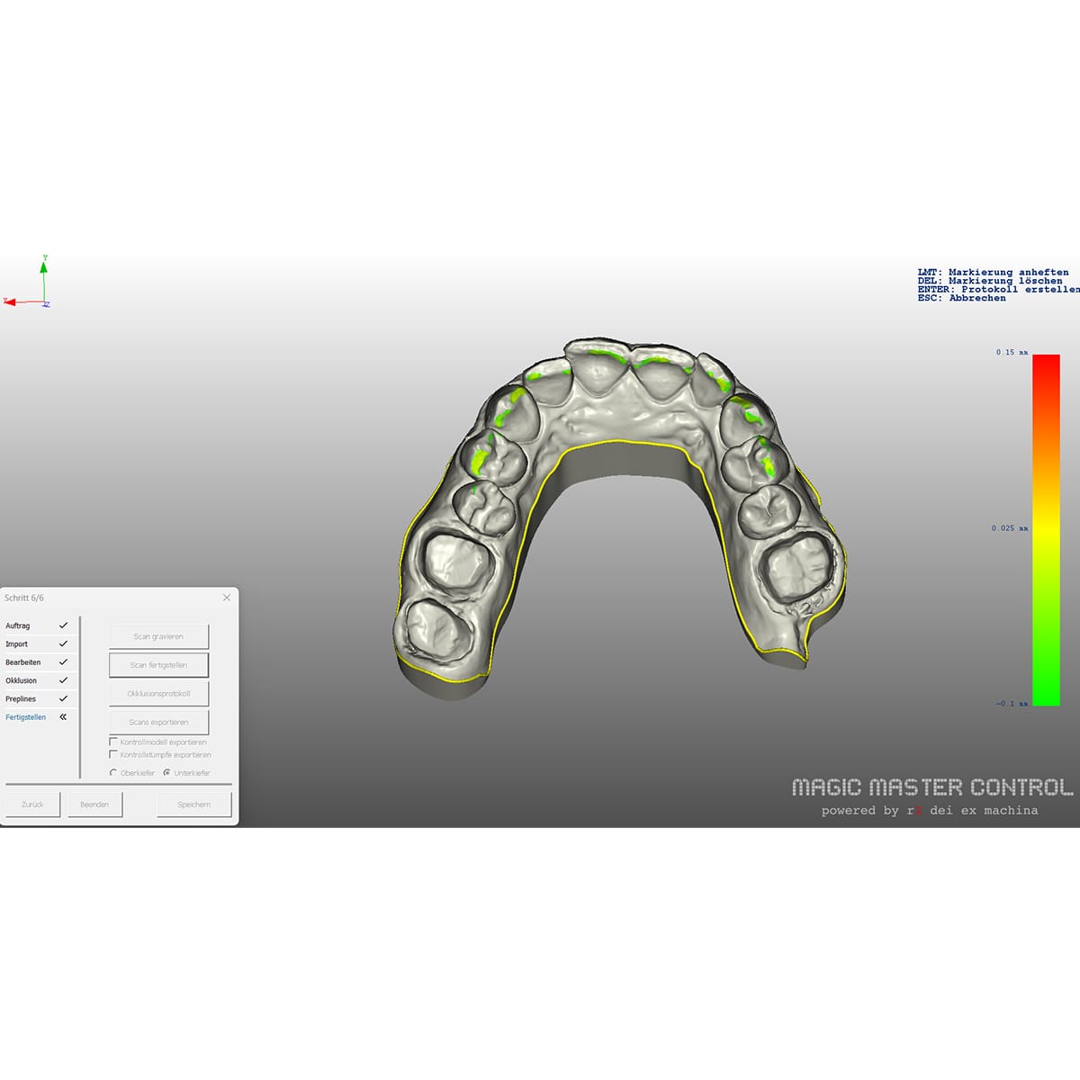 Magic Master Control / Software – Baumann Dental, CAD/CAM-Software