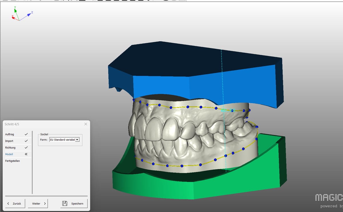 Magic® Model 3D Ortho, Ortho-Modul for Dental 1490 4079 – Baumann Dental, Software