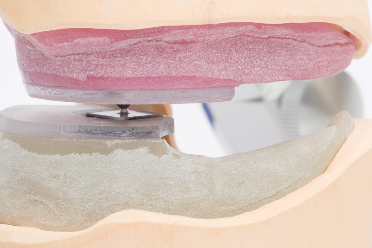 CPS standard pack 1170 1270 – Baumann Dental, Pins und Modellsysteme