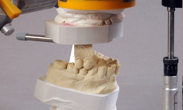 Occlusometer for SAM² 1090 0616