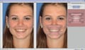 OnyxCeph3TM Module Smile 3D 410-000-16 – DENTAURUM, CAD/CAM-Software