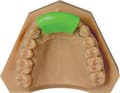 Orthodontic demonstration model prime4me® RETAIN3R 892-000-29