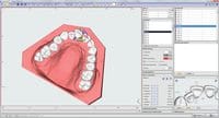 OnyxCeph³™ module Aligner 3D 410-000-09 – DENTAURUM, Software