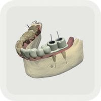 TRIOS Implant Studio app 420-210-02
