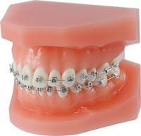 Orthodontic demonstration model discovery® smart 892-000-20