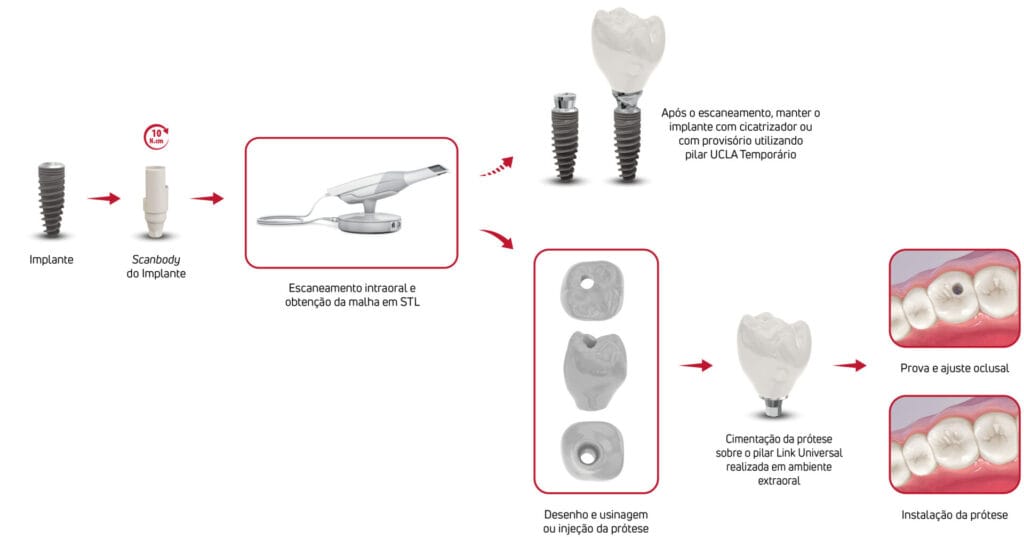 Konischer Pfeiler 20° – A. S. Technology Components Especia Especiais Ltda. TitaniumFix, Implantologie
