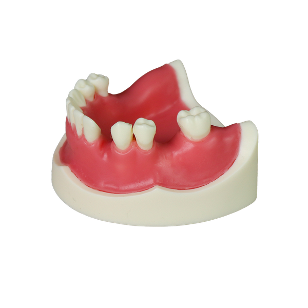 Implant Modei JG-YZ-7