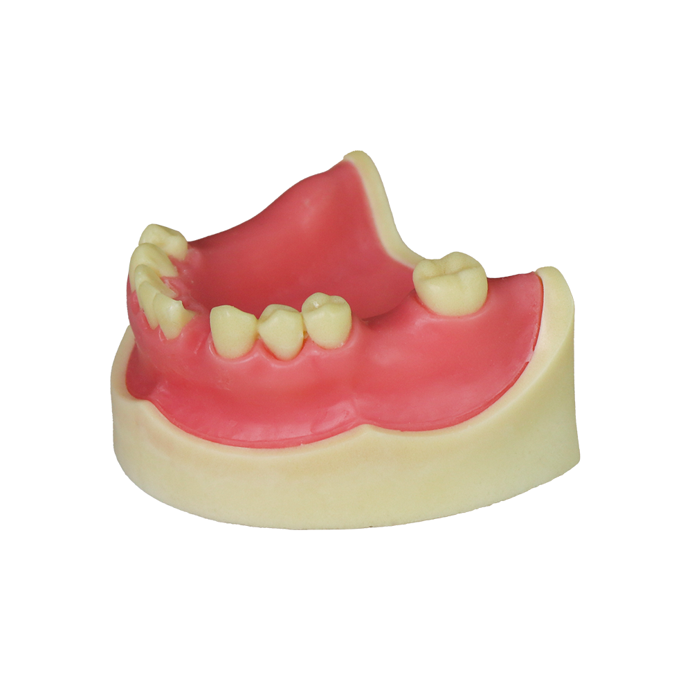 Implant Model JG-YZ-9 – FOSHAN JINGLE MEDICAL EQUIPMENT CO.,LTD., Demomodelle