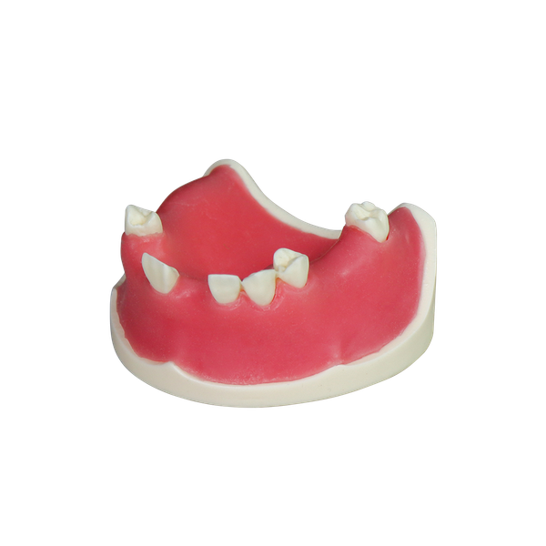 Implant Model JG-YZ-6
