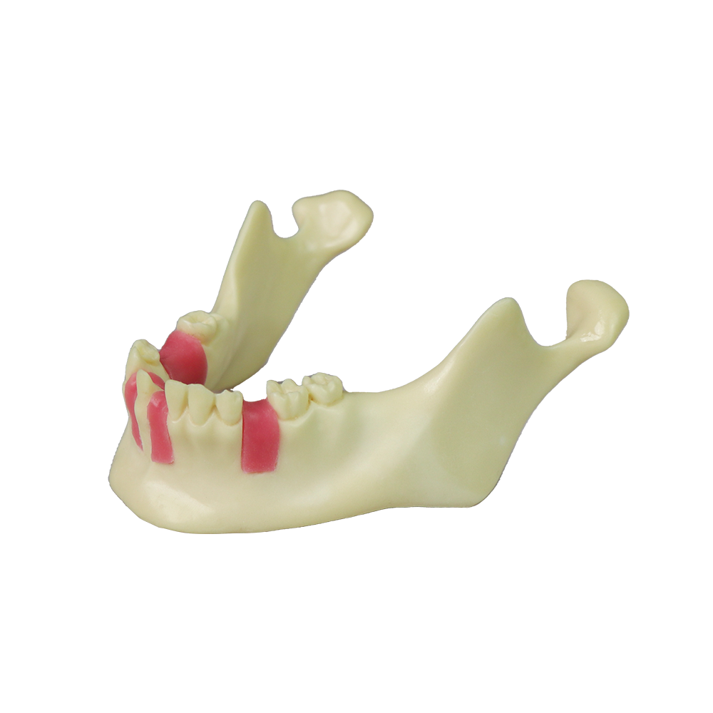Mandibular Dental Implant Model – Foamed Resin for Implant Practice JG-Y12-TG – FOSHAN JINGLE MEDICAL EQUIPMENT CO.,LTD., Demomodelle