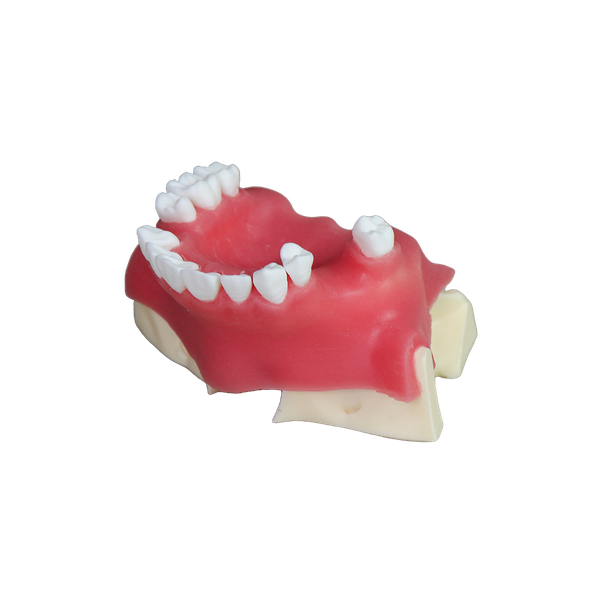 Sinus Lift Dental Model – Hard Resin with Soft Gums for Maxillary Sinus Training JG-Y26