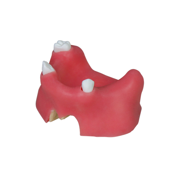 Sinus Lift Dental Model – Hard Resin with Soft Gums for Maxillary Sinus Training JG-YZ-11