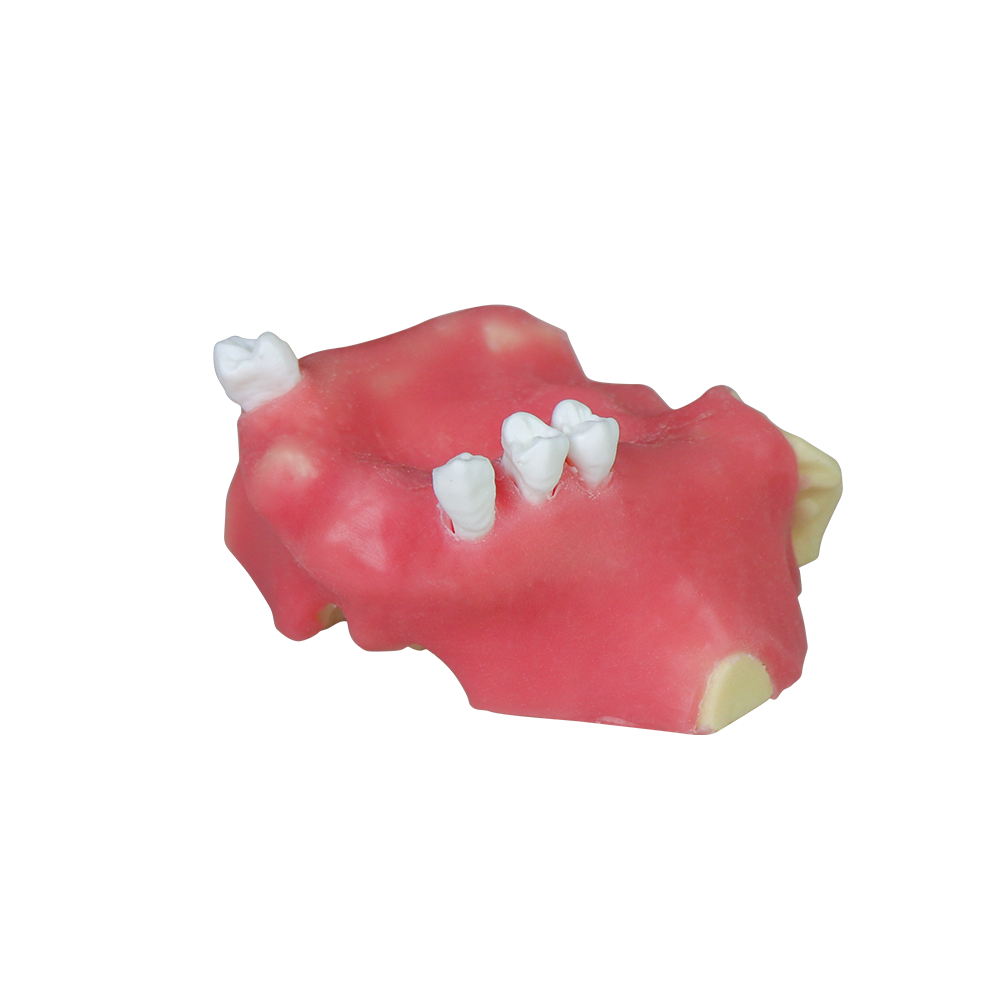 Sinus Lift Dental Model – Hard Resin with Soft Gums for Maxillary Sinus Training JG-Y11-S2 – FOSHAN JINGLE MEDICAL EQUIPMENT CO.,LTD., Demomodelle