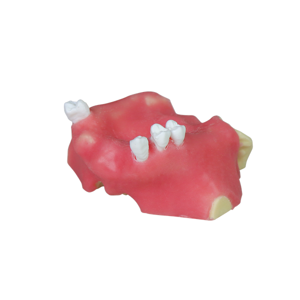 Sinus Lift Dental Model – Hard Resin with Soft Gums for Maxillary Sinus Training JG-Y11-S2