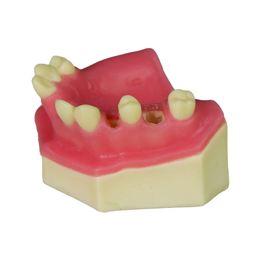 Sinus Lift Dental Model – Hard Resin with Soft Gums for Maxillary Sinus Training JG-Y8-F10 – FOSHAN JINGLE MEDICAL EQUIPMENT CO.,LTD., Demomodelle