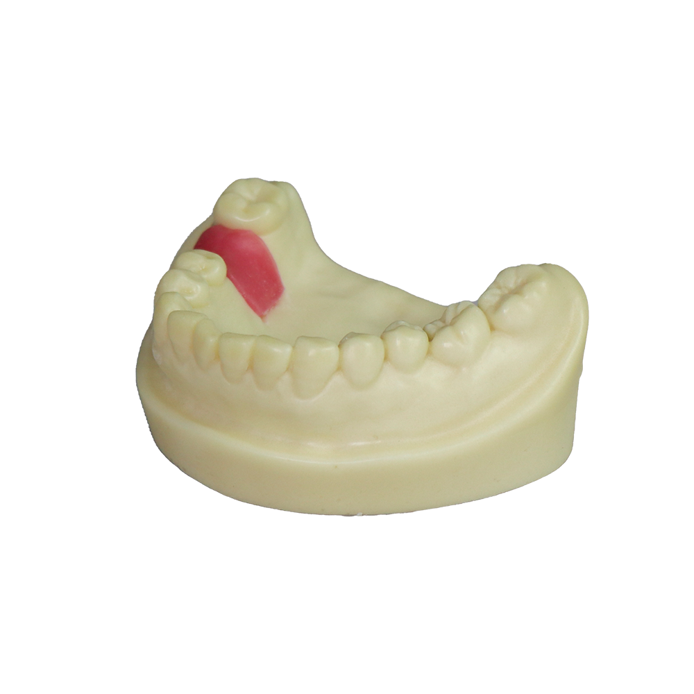 Dental Implant Model – D2 Soft Resin with Gums for Implant Training JG-Y8-F9 – FOSHAN JINGLE MEDICAL EQUIPMENT CO.,LTD., Demomodelle