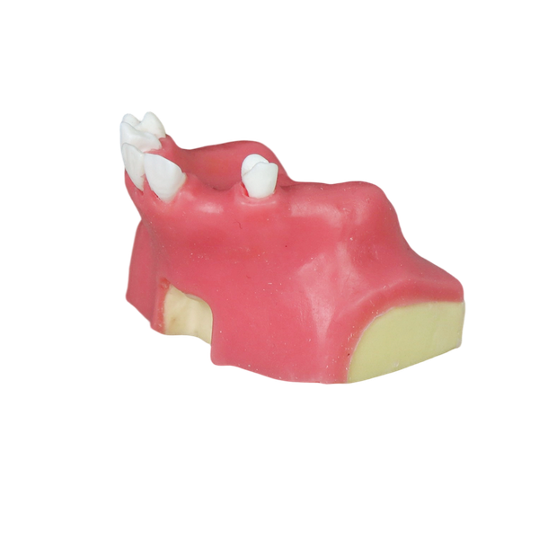 Sinus Lift Dental Model – Hard Resin with Soft Gums for Maxillary Sinus Training JG-Y11-S6