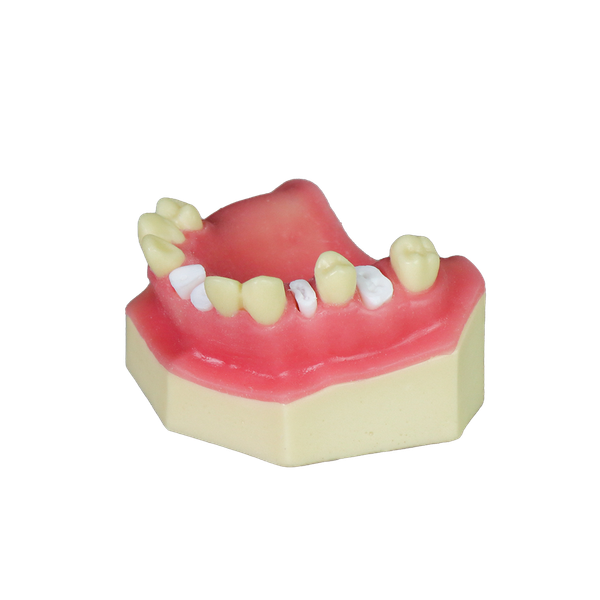 Sinus Lift Dental Model – Hard Resin with Soft Gums for Maxillary Sinus Training JG-Y8-F5