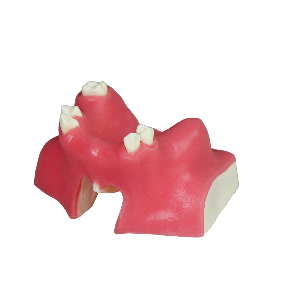 Sinus Lift Dental Model – Hard Resin with Soft Gums for Maxillary Sinus Training JG-Y21 – FOSHAN JINGLE MEDICAL EQUIPMENT CO.,LTD., Demomodelle