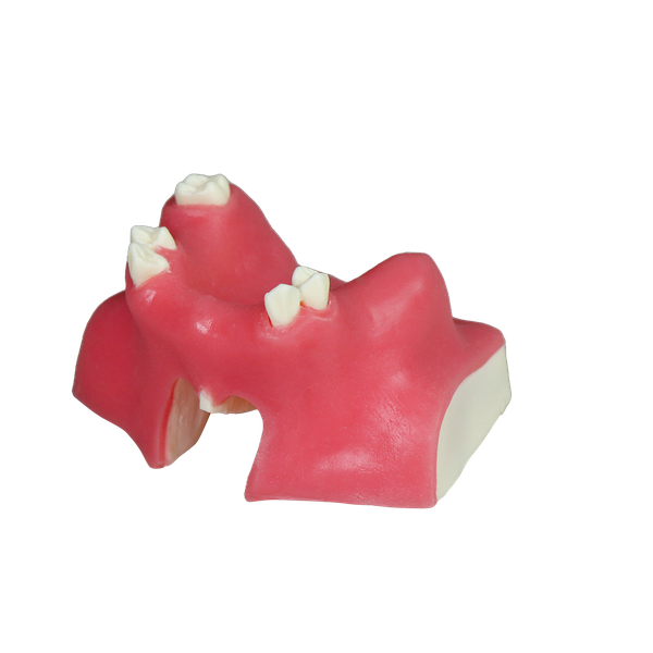 Sinus Lift Dental Model – Hard Resin with Soft Gums for Maxillary Sinus Training JG-Y21