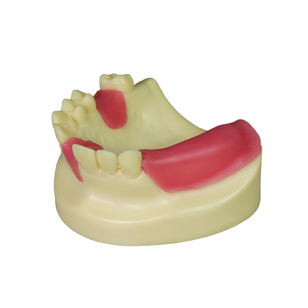 Fast Implant Dental Model – Soft Resin and Soft Gums for Implant Training JG-Y8-F11 – FOSHAN JINGLE MEDICAL EQUIPMENT CO.,LTD., Demomodelle