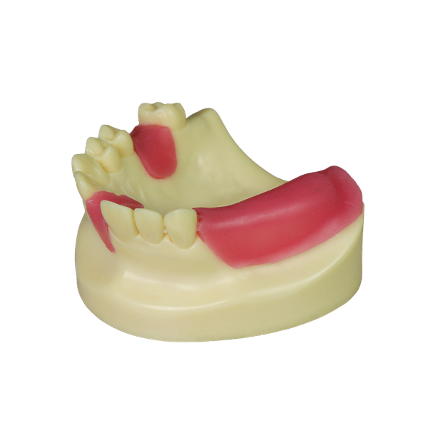 Fast Implant Dental Model – Soft Resin and Soft Gums for Implant Training JG-Y8-F11