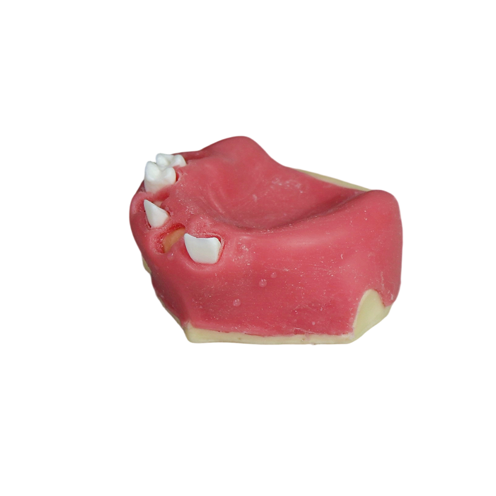 Fast Implant Dental Model – Soft Resin and Soft Gums for Implant Training JG-Y26-2 – FOSHAN JINGLE MEDICAL EQUIPMENT CO.,LTD., Demomodelle