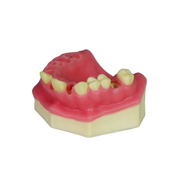 Fast Implant Dental Model – Soft Resin and Soft Gums for Implant Training JG-Y8-F3