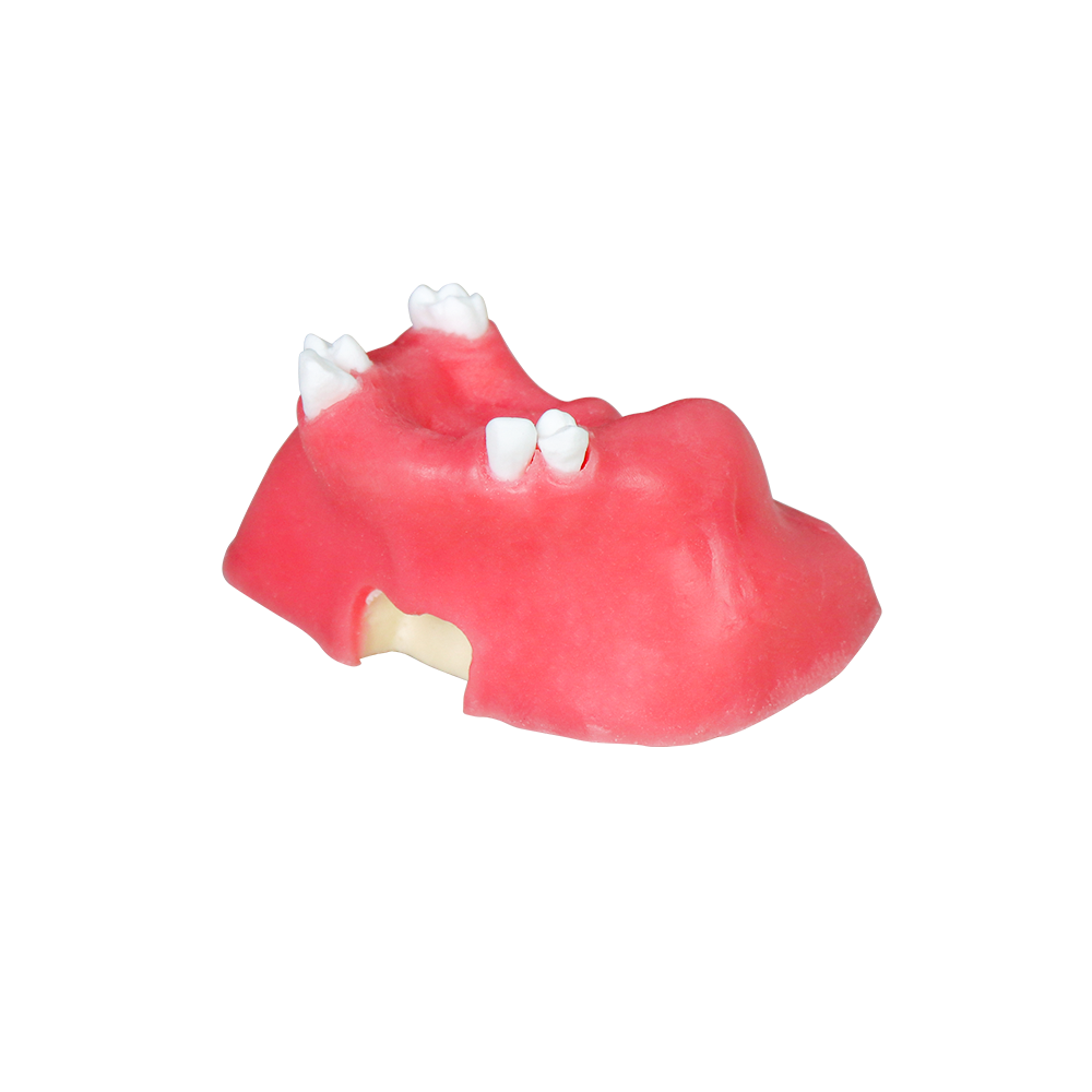 Sinus Lift Dental Model – Hard Resin with Soft Gums for Maxillary Sinus Training JG-Y11-S5 – FOSHAN JINGLE MEDICAL EQUIPMENT CO.,LTD., Demomodelle