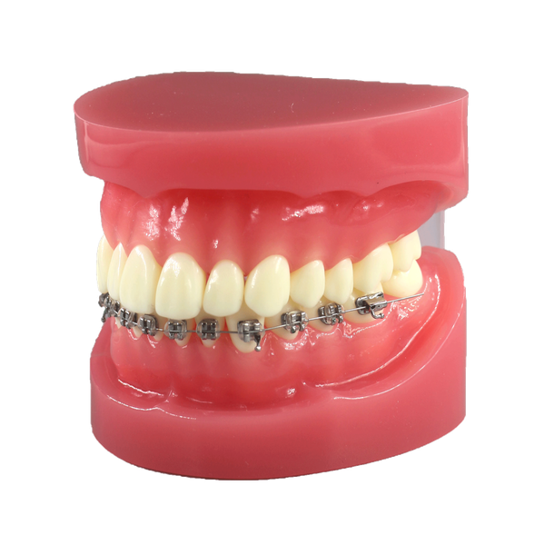 Orthodontic Demonstration Model JG-Y7-Y – 28 Teeth, Optional Brackets