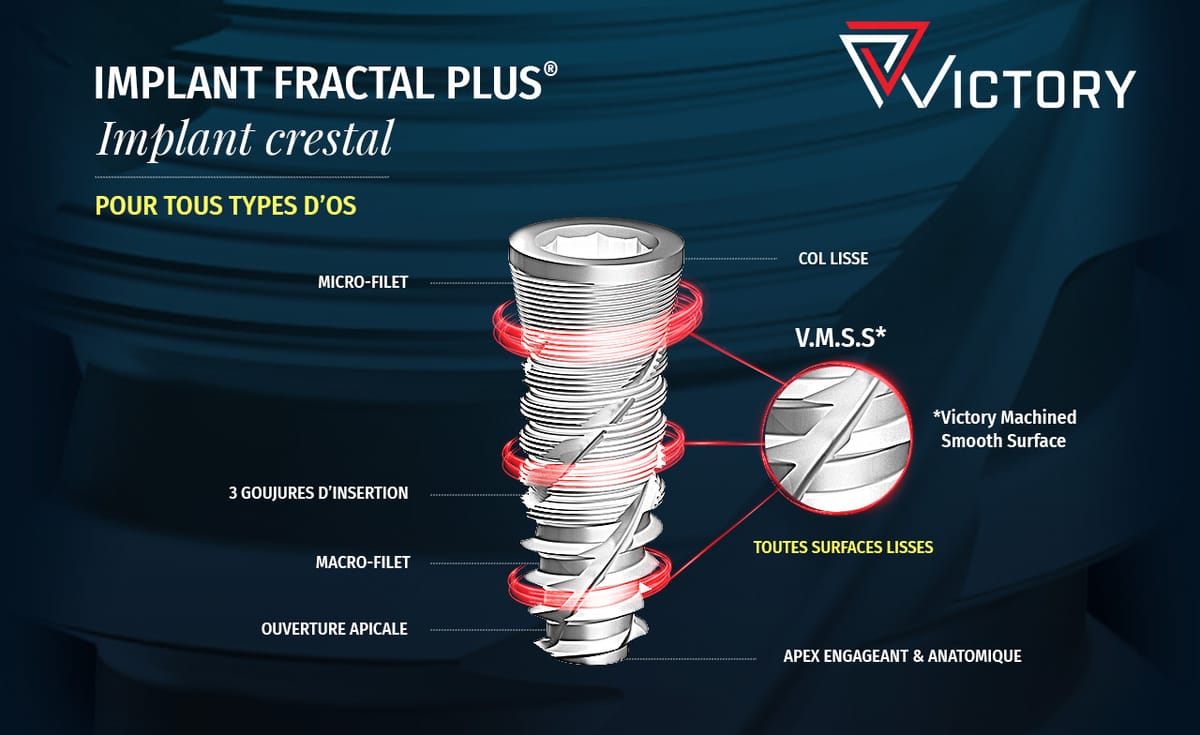 Implant Fractal Plus® – Visy, Implantate