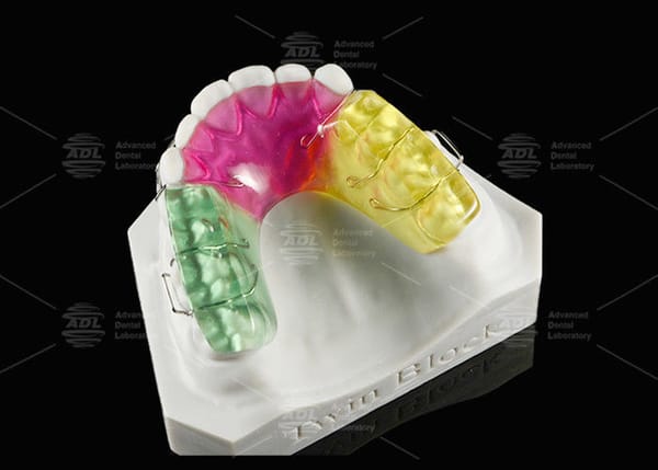 Acrylic Twin Block Orthodontic Appliance For Correcting Malocclusion
