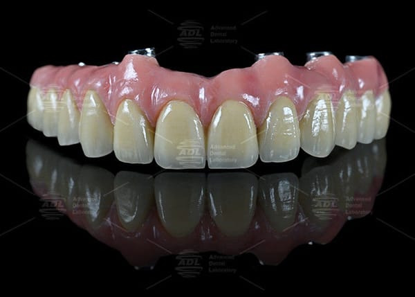 China Dental Lab Hybrid Bridge Implant Bar Malong Design Screw retained Or Cemented Installation Method For Precision Dental Applications