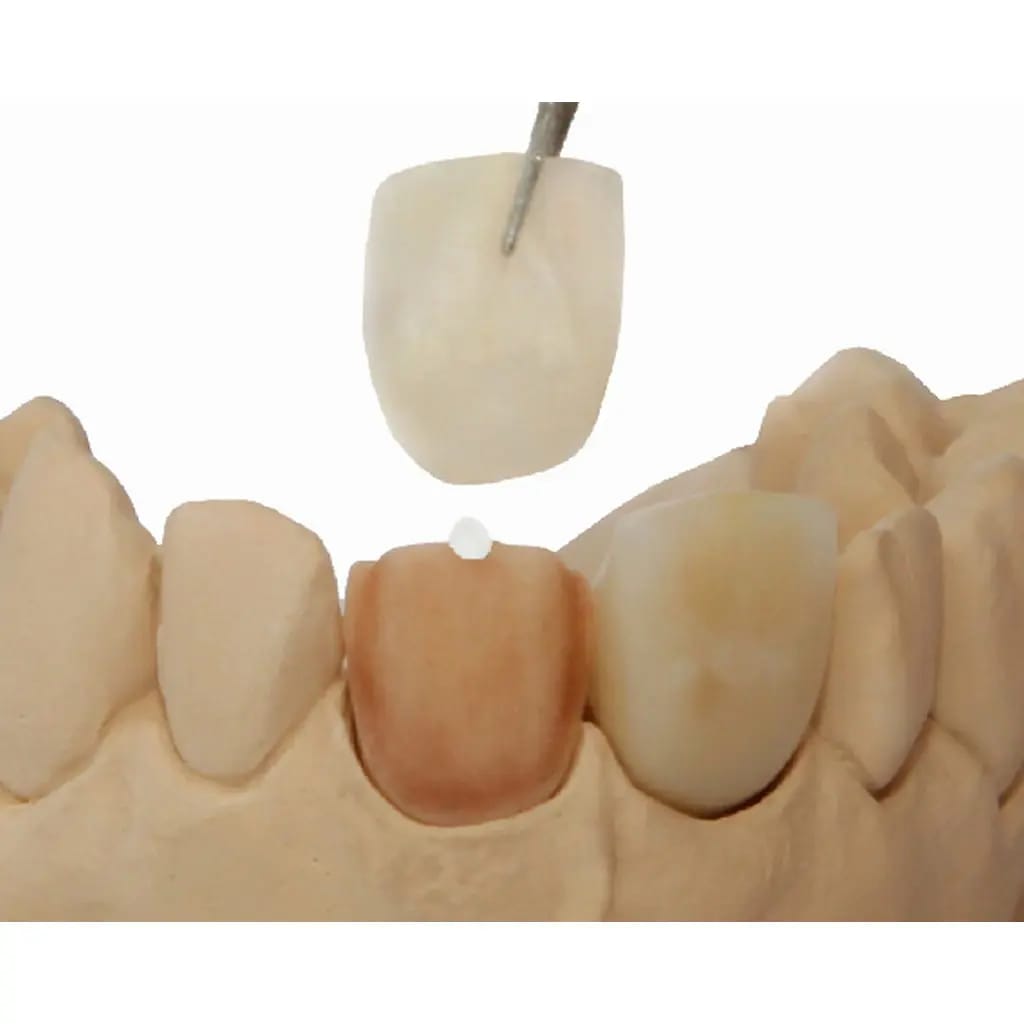 GLUFI - temporary CAD/CAM fixation material, 5 ml – al dente Dentalprodukte, Provisorische Befestigungszemente