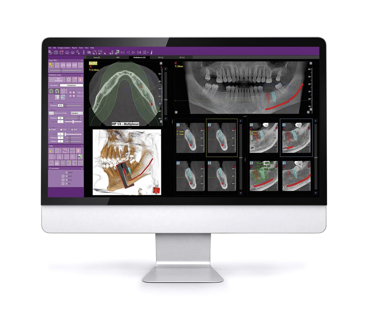 iRYS – Castellini, CAD/CAM-Software