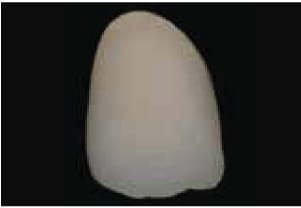 DC™ 9.2 Verblendkeramik für Lithium Disilikat und Zirkonoxid – Ceramay GmbH & Co. KG, Keramikmassen