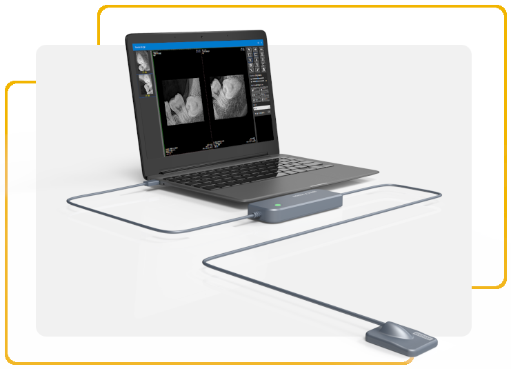 Evolve – RX Sensor – Evolve Technology, Röntgen